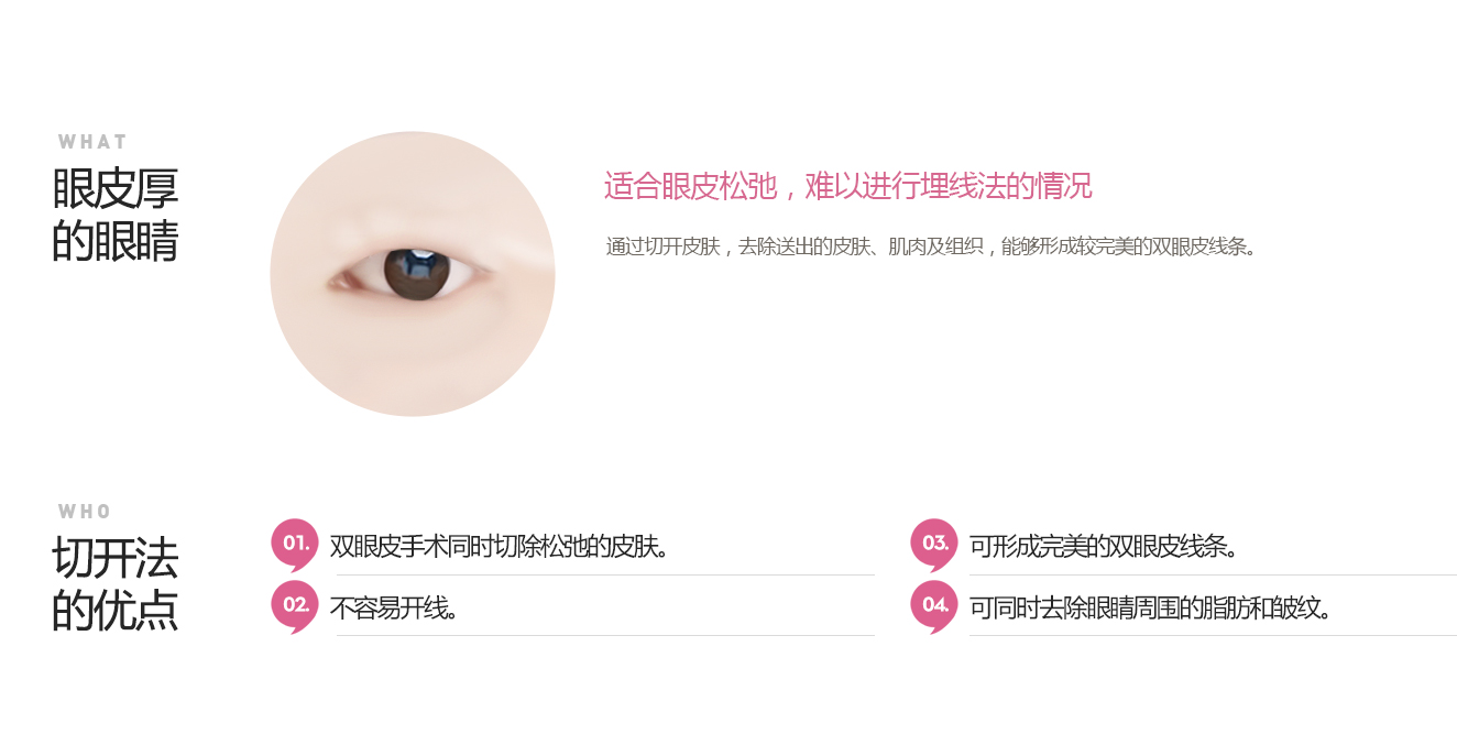 눈꺼풀이두툼한눈