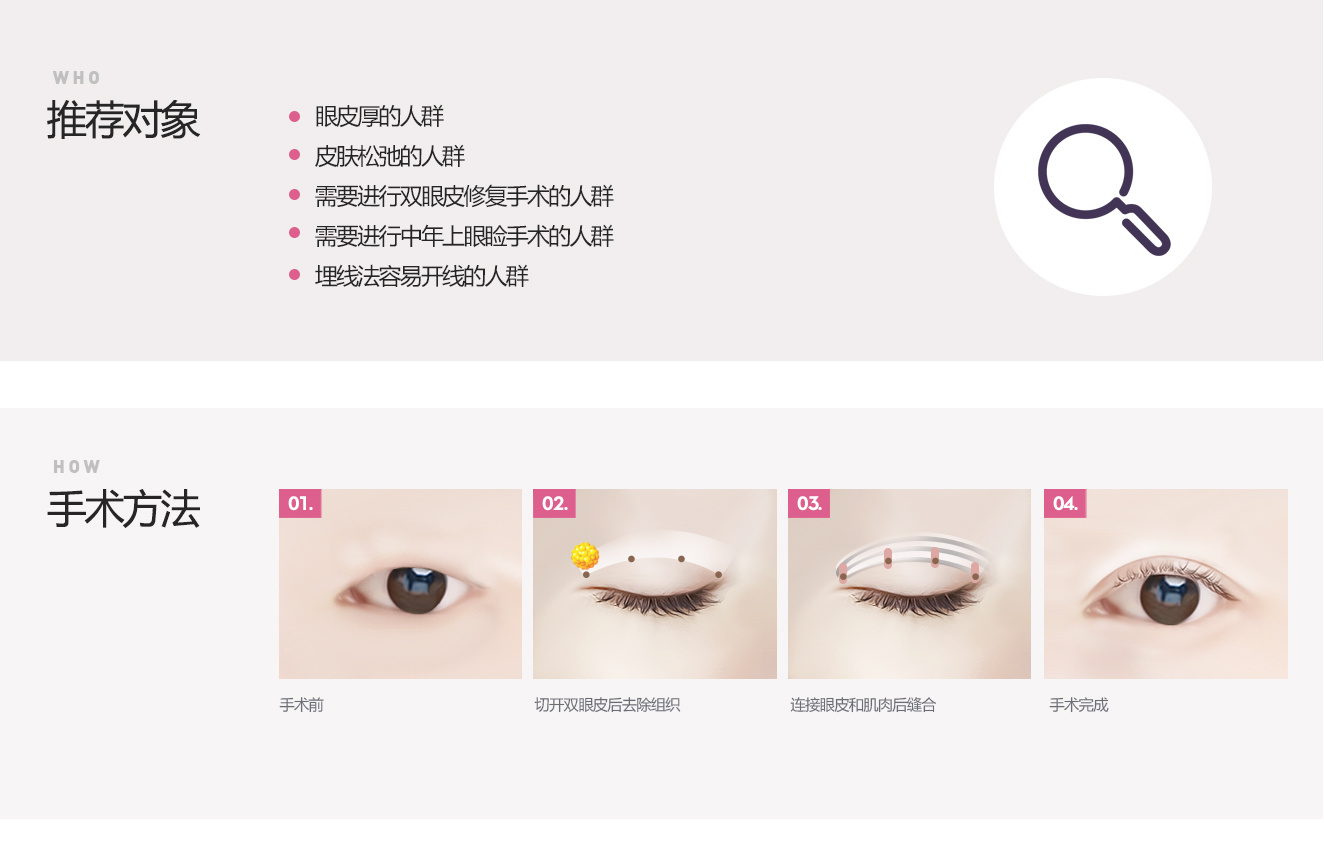 눈꺼풀이두툼한눈