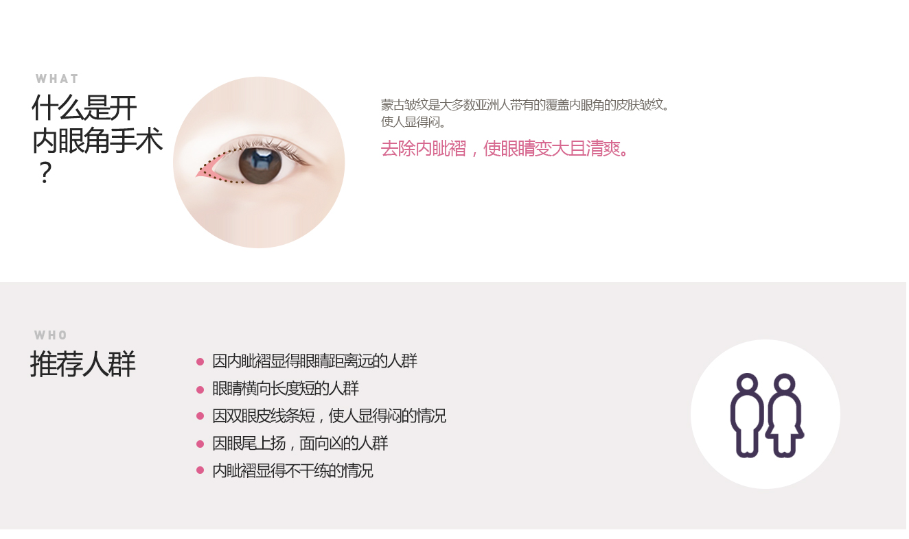 눈사이가멀어보이는분눈