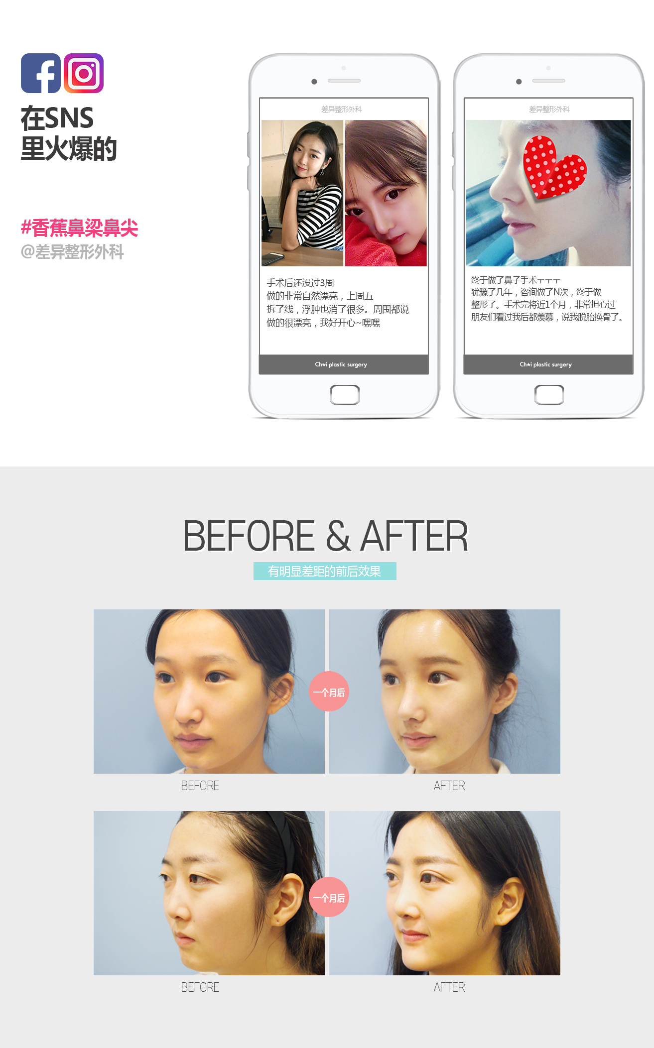 바나나 콧대+코끝