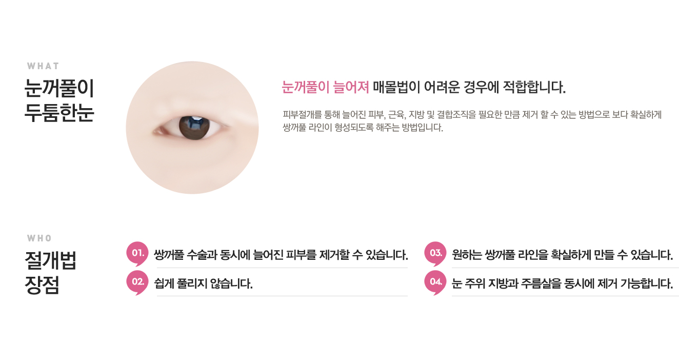 눈꺼풀이두툼한눈