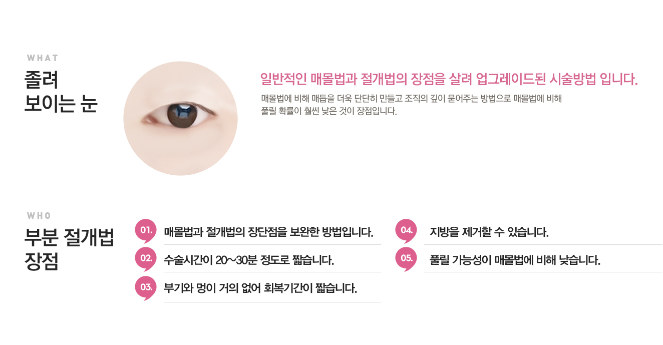 눈꺼풀이얇은눈