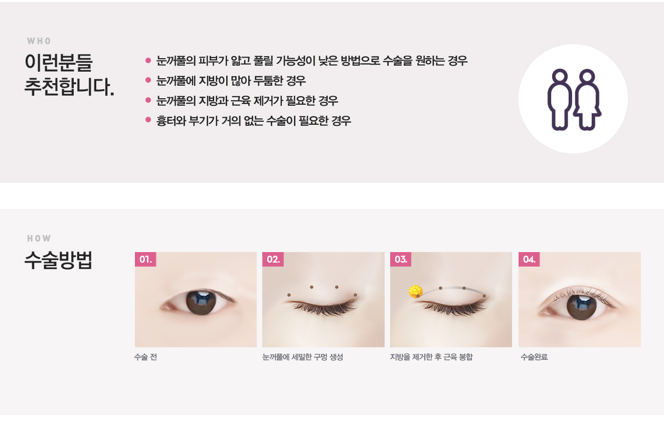 눈꺼풀이얇은눈