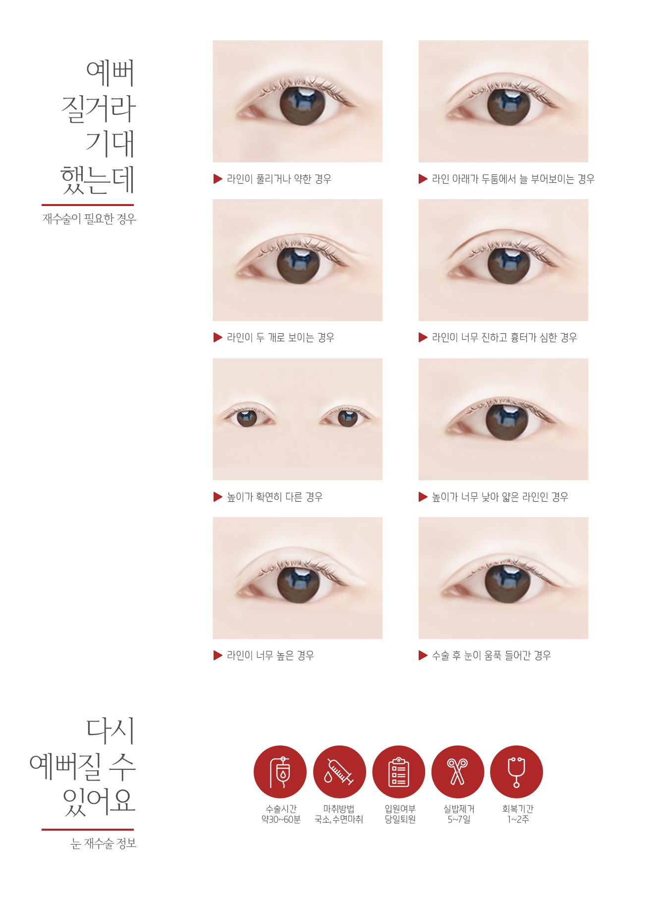 쌍꺼풀라인이짝짝이인눈