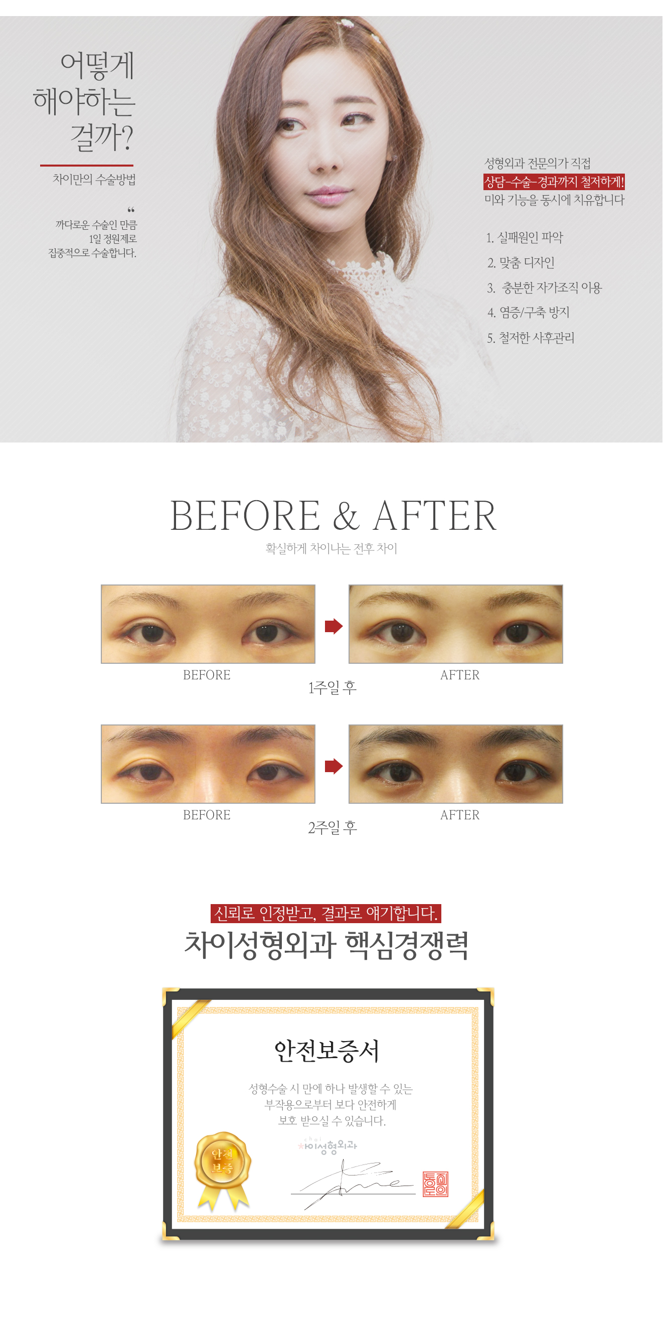 쌍꺼풀라인이짝짝이인눈