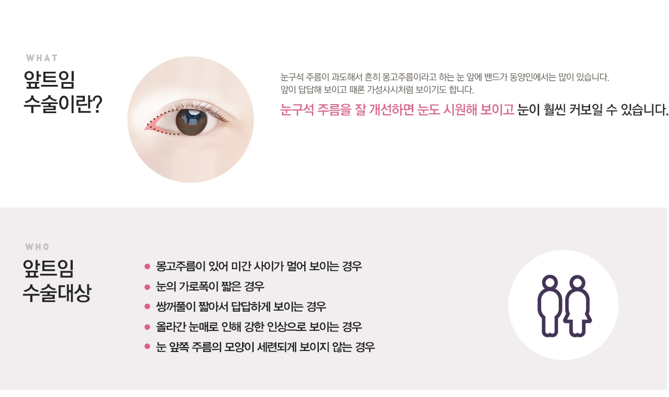 눈사이가멀어보이는분눈