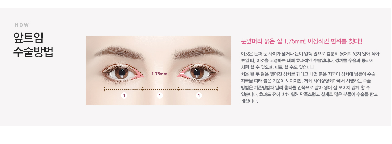 눈사이가멀어보이는분눈