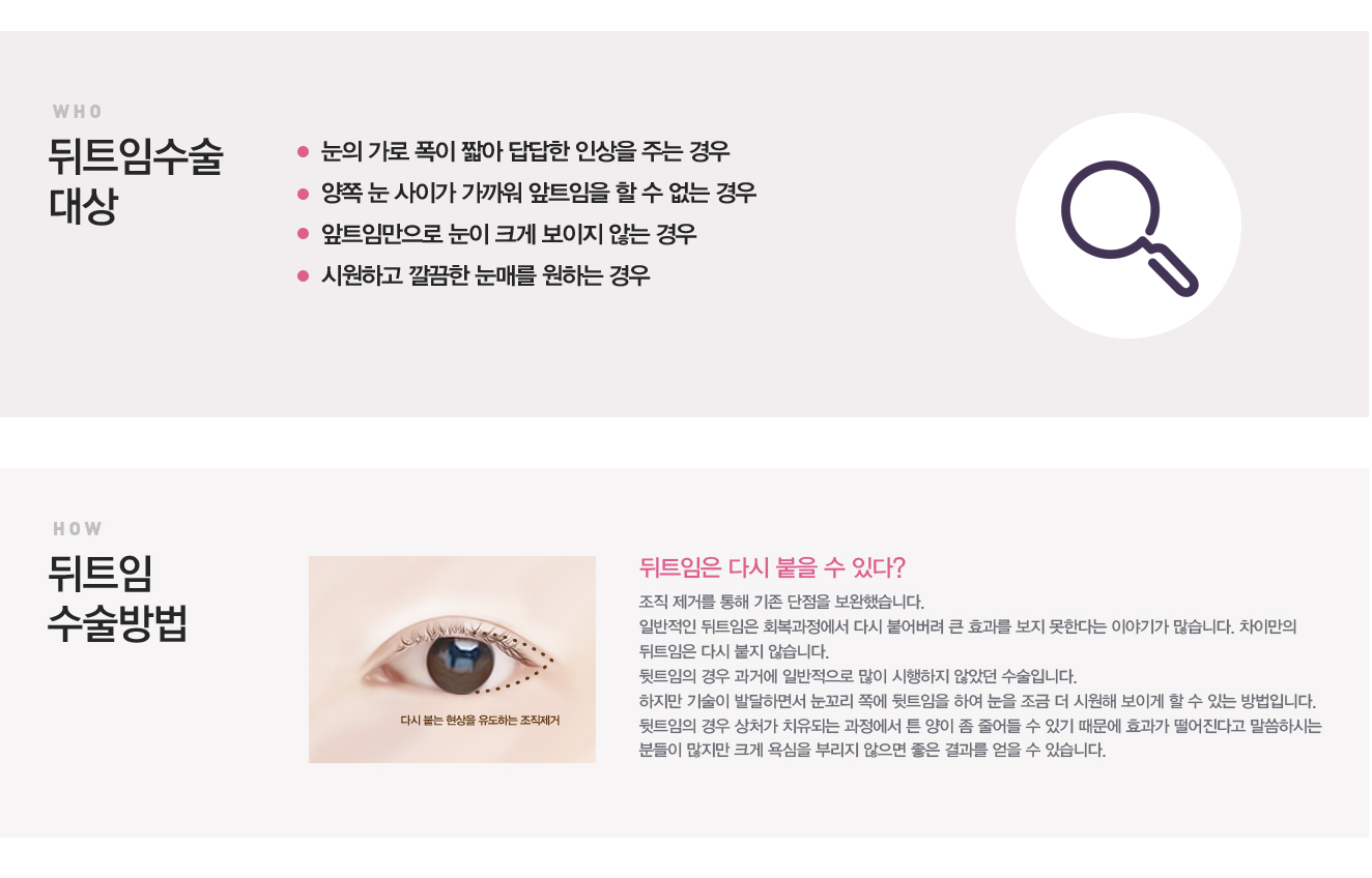 눈의가로길이가짧은눈