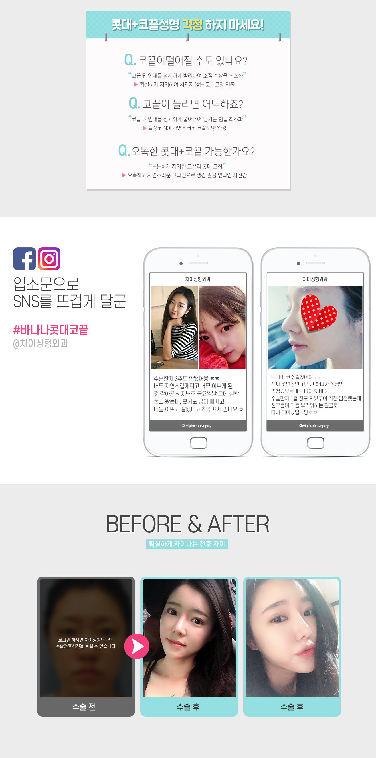 바나나 콧대+코끝