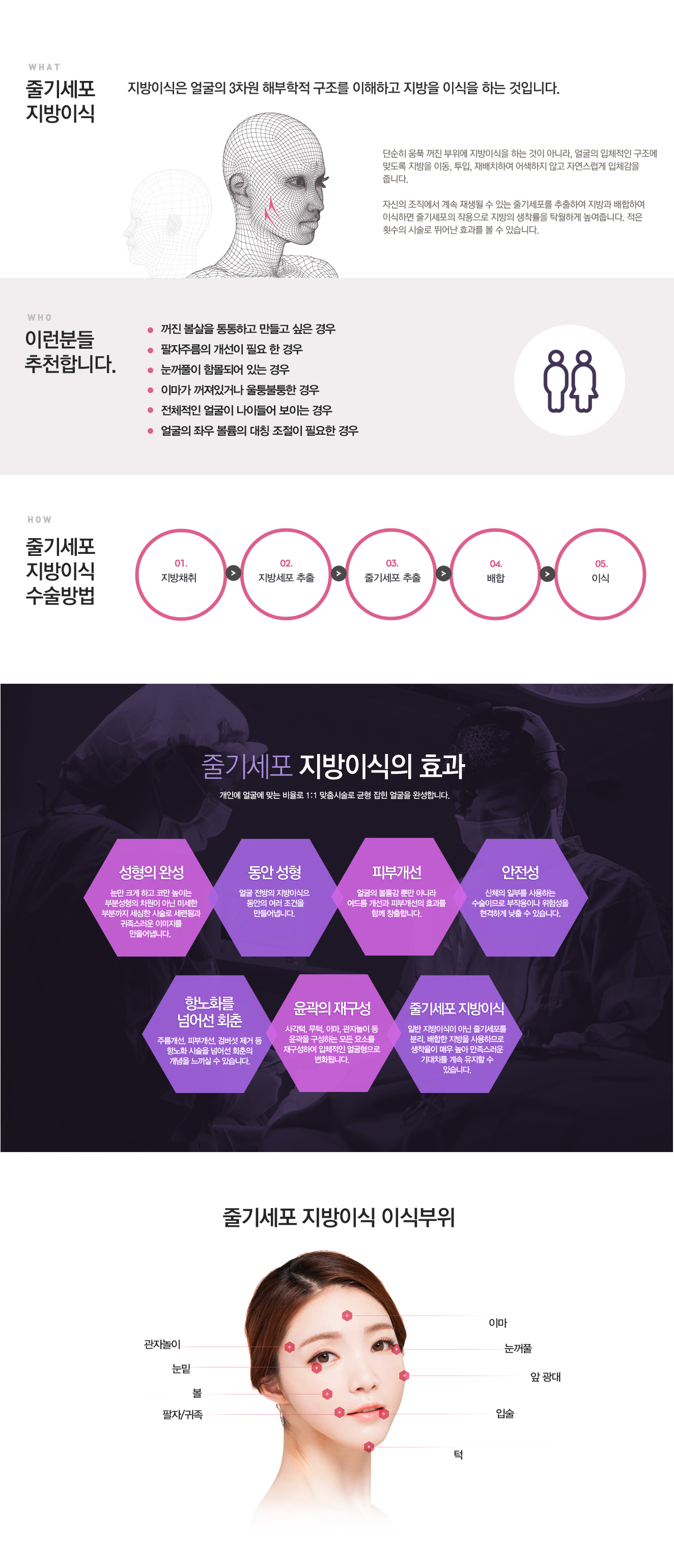 줄기세포지방이식