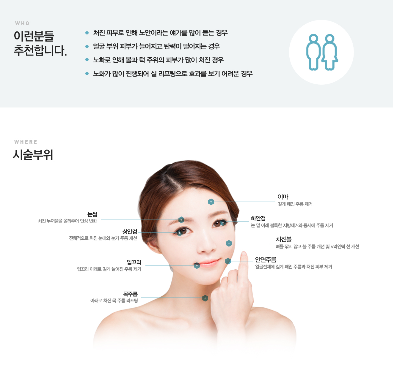 최소절개안면거상술